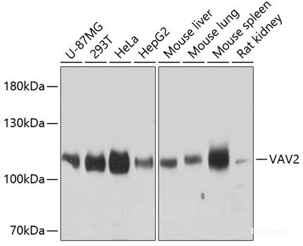 Immunohistochemistry of paraffin-embedded Rat heart using FRMD6 Polyclonal Antibody at dilution of 1:100 (40x lens).