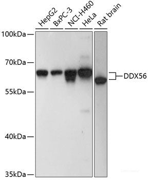 Immunofluorescence analysis of MCF-7 cells using Phospho-ABL1(Y204) Polyclonal Antibody
