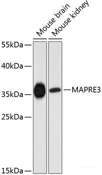 Immunofluorescence analysis of MCF-7 cells using Phospho-ELK1(S383) Polyclonal Antibody