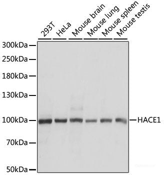 Immunofluorescence analysis of MCF-7 cells using Phospho-c-Fos(T232) Polyclonal Antibody