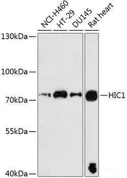 Western blot analysis of extracts of various cell lines using Phospho-c-Jun(S73) Polyclonal Antibody at dilution of 1:1000. HeLa cells were treated by UV at room tempeRature for 15-30 minutes. C6 cells were treated by UV at room tempeRature for 15-30 minutes.