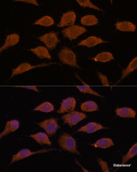 Western blot analysis of extracts of various cell lines using Phospho-MAP2K1(S298) Polyclonal Antibody at dilution of 1:1000.