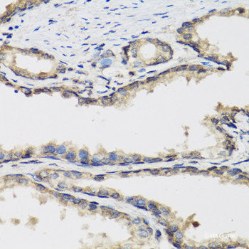 Immunohistochemistry of paraffin-embedded Rat brain using Phospho-Stat3(Y705) Polyclonal Antibody at dilution of 1:100 (40x lens).