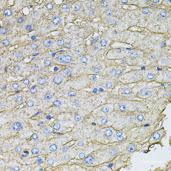Western blot analysis of extracts of HeLa cells using Phospho-NF-kB p65(S276) Polyclonal Antibody.
