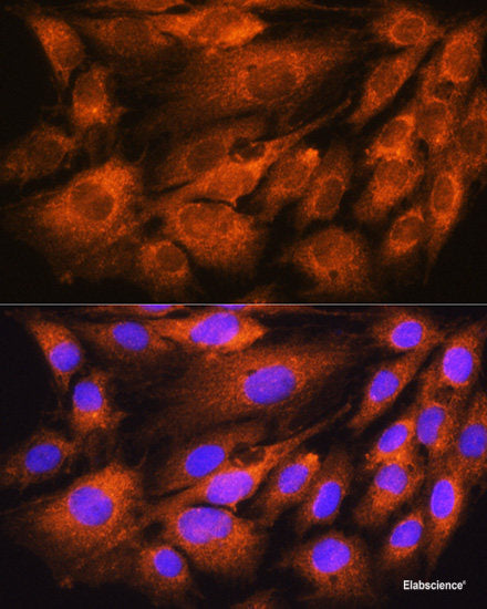 Western blot analysis of extracts from Mouse Brain tissue using Phospho-SYN1(S9) Polyclonal Antibody.