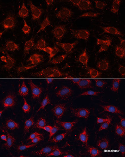 Immunofluorescence analysis of U2OS cells using Phospho-BRCA1(S988) Polyclonal Antibody at dilution of 1:100. Blue: DAPI for nuclear staining.