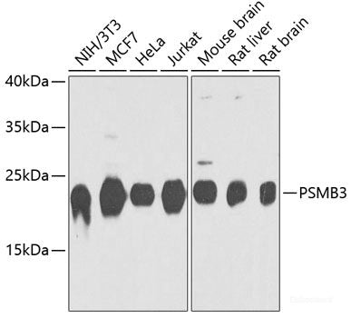 Western blot analysis of extracts from 293 cells using Phospho-CDK6(Y13) Polyclonal Antibody.