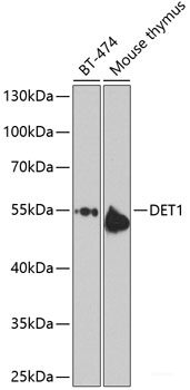 Western blot analysis of extracts of MDA-MB435 cells using Phospho-NFkB p100(S866) Polyclonal Antibody.