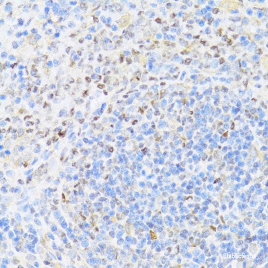 Western blot analysis of extracts from Mouse brain tissue using Phospho-SNCA(S129) Polyclonal Antibody.