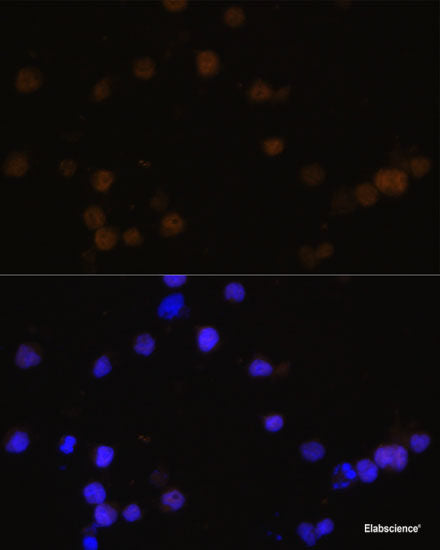 Immunohistochemistry of paraffin-embedded Mouse kidney using ENDOG Polyclonal Antibody at dilution of 1:100 (40x lens).