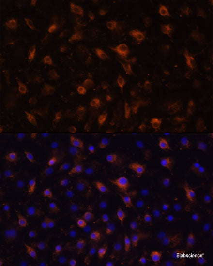Immunohistochemistry of paraffin-embedded Rat liver using HDAC5 Polyclonal Antibody at dilution of 1:100 (40x lens).