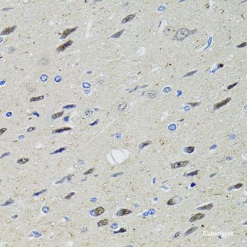 Immunohistochemistry of paraffin-embedded Human prostate using ATP1A Polyclonal Antibody at dilution of 1:100 (40x lens).