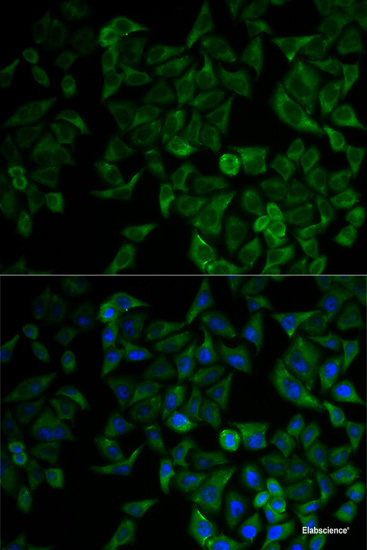 Immunofluorescence analysis of HeLa cells using SPHK1 Polyclonal Antibody