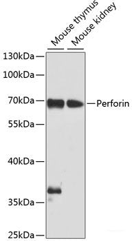 Immunohistochemistry of paraffin-embedded Rat brain using NRF2 Polyclonal Antibody at dilution of 1:100 (40x lens).