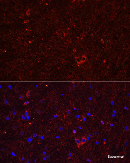 Immunohistochemistry of paraffin-embedded Rat brain using ACVR1C Polyclonal Antibody at dilution of 1:100 (40x lens).