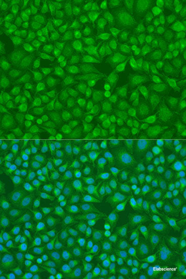 Immunohistochemistry of paraffin-embedded Rat heart using SOCS3 Polyclonal Antibody at dilution of 1:100 (40x lens).
