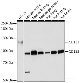 Immunohistochemistry of paraffin-embedded Rat kidney using PAK1 Polyclonal Antibody at dilution of 1:200 (40x lens).