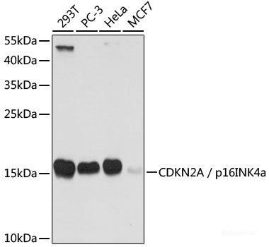 Western blot analysis of extracts of various cell lines using Hsp60 Polyclonal Antibody at dilution of 1:1000.