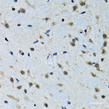 Western blot analysis of extracts of various cell lines using PPIA Polyclonal Antibody at dilution of 1:1000.