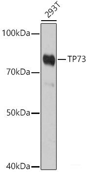 Immunofluorescence analysis of HeLa cells using KLF6 Polyclonal Antibody at dilution of 1:100. Blue: DAPI for nuclear staining.