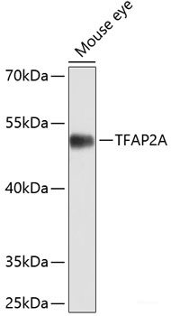 Western blot analysis of extracts of various cell lines using HPCAL1 Polyclonal Antibody at dilution of 1:1000.