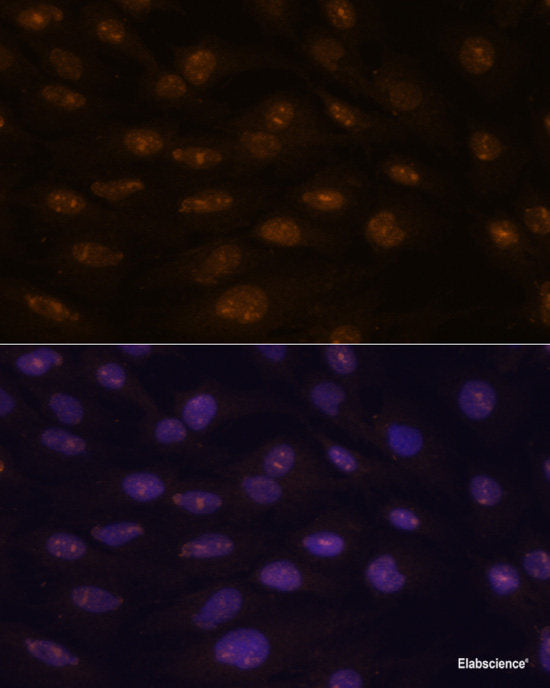 Immunohistochemistry of paraffin-embedded Human stomach using ATP4B Polyclonal Antibody at dilution of 1:100 (40x lens).