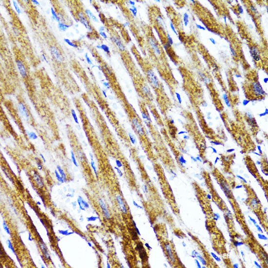 Western blot analysis of extracts of Mouse kidney using ZCCHC4 Polyclonal Antibody at dilution of 1:1000.