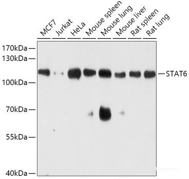 Western blot analysis of extracts of Mouse kidney using ZSCAN4C Polyclonal Antibody at dilution of 1:1000.