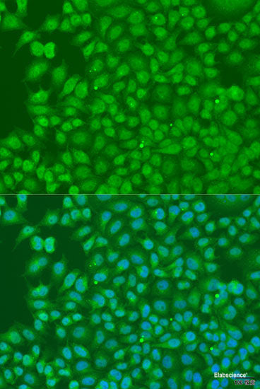 Immunohistochemistry of paraffin-embedded Rat liver using SEPT4 Polyclonal Antibody at dilution of 1:100 (40x lens).