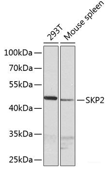 Western blot analysis of extracts of various cell lines using SH3BP2 Polyclonal Antibody at dilution of 1:1000.