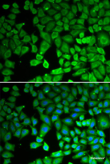 Western blot analysis of extracts of various cell lines using SPG7 Polyclonal Antibody at dilution of 1:1000.