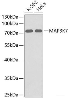Immunohistochemistry of paraffin-embedded Rat ovary using KIF14 Polyclonal Antibody at dilution of 1:100 (40x lens).
