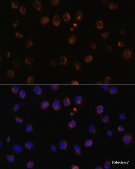 Immunohistochemistry of paraffin-embedded Rat brain using EGLN1/EGLN2 Polyclonal Antibody at dilution of 1:100 (40x lens).