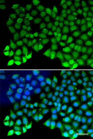 Western blot analysis of extracts of various cell lines using KRT2 Polyclonal Antibody at dilution of 1:1000.