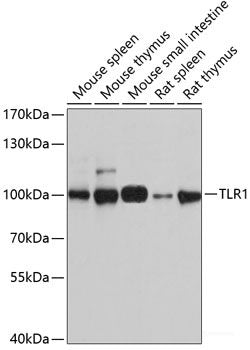 Immunohistochemistry of paraffin-embedded Human breast cancer using STOML2 Polyclonal Antibody at dilution of 1:100 (40x lens).