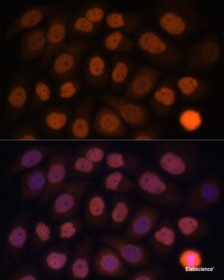 Immunohistochemistry of paraffin-embedded Rat liver using SLC4A5 Polyclonal Antibody at dilution of 1:100 (40x lens).