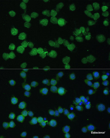 Western blot analysis of extracts of various cell lines using NFKBIZ Polyclonal Antibody at dilution of 1:1000.