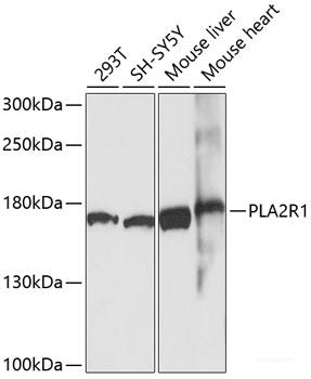 Western blot analysis of extracts of various cell line using FZD6 Polyclonal Antibody at dilution of 1:1000.