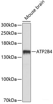 Immunofluorescence analysis of HeLa cells using VDAC3 Polyclonal Antibody at dilution of 1:100 (40x lens). Blue: DAPI for nuclear staining.