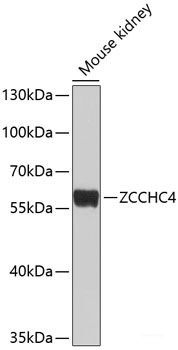 Immunofluorescence analysis of C6 cells using LGMN Polyclonal Antibody at dilution of 1:100 (40x lens). Blue: DAPI for nuclear staining.