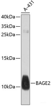 Immunofluorescence analysis of H9C2 cells using YWHAE Polyclonal Antibody at dilution of 1:100. Blue: DAPI for nuclear staining.