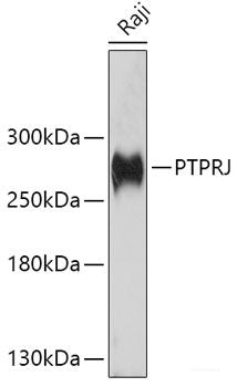 Immunofluorescence analysis of H9C2 cells using SRPRB Polyclonal Antibody at dilution of 1:100. Blue: DAPI for nuclear staining.