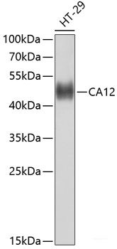 Western blot analysis of extracts of various cell lines using CALR Polyclonal Antibody at dilution of 1:1000.