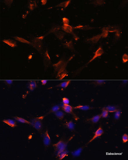 Immunohistochemistry of paraffin-embedded Human prostate using RNASE13 Polyclonal Antibody at dilution of 1:100 (40x lens).