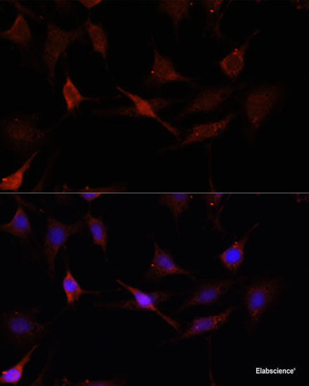Western blot analysis of extracts of Mouse stomach using KLK14 Polyclonal Antibody at dilution of 1:1000.