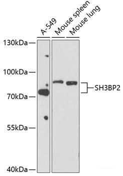 Western blot analysis of extracts of Rat thymus using NTF4 Polyclonal Antibody at dilution of 1:1000.