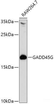 Western blot analysis of extracts of various cell lines using TYMP Polyclonal Antibody at dilution of 1:1000.