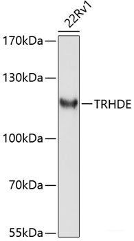 Immunohistochemistry of paraffin-embedded Human tonsil using MTA2 Polyclonal Antibody at dilution of 1:100 (40x lens).