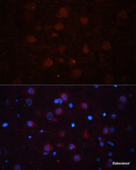 Immunohistochemistry of paraffin-embedded Mouse spleen using APP Polyclonal Antibody at dilution of 1:100 (40x lens).
