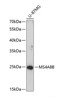 Immunohistochemistry of paraffin-embedded Mouse kidney using Tau Polyclonal Antibody at dilution of 1:100 (40x lens).